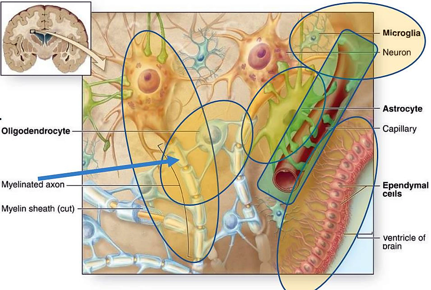 Dibujo en color del tejido cerebral con los tipos celulares destacados en óvalos, y arriba un pequeño corte del cerebro.
