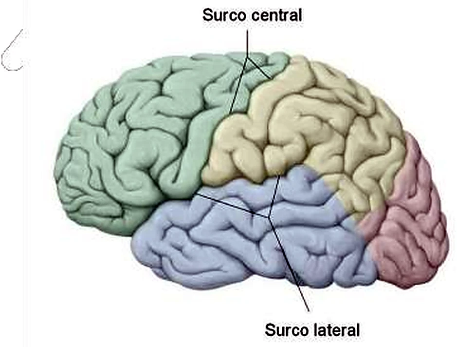 Esquema de las áreas del lenguaje.