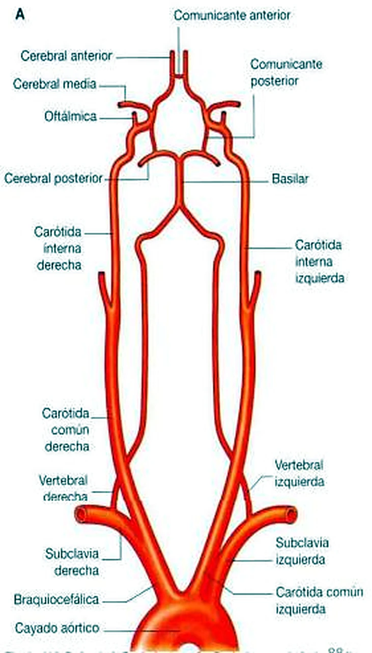 Esquema de la arteria vertebral.