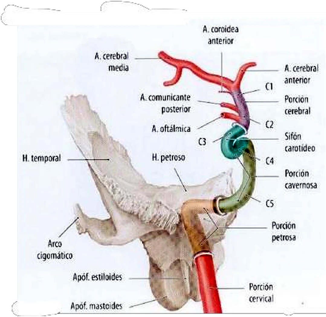 Imagen de la arteria basilar.