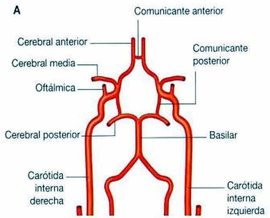 Imagen de la arteria coroidea.