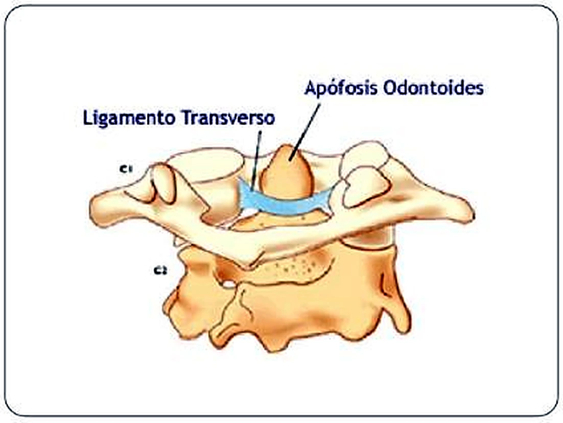 Las dos primeras vértebras cervicales, la apófisis odontoides y el ligamento transverso en azul.