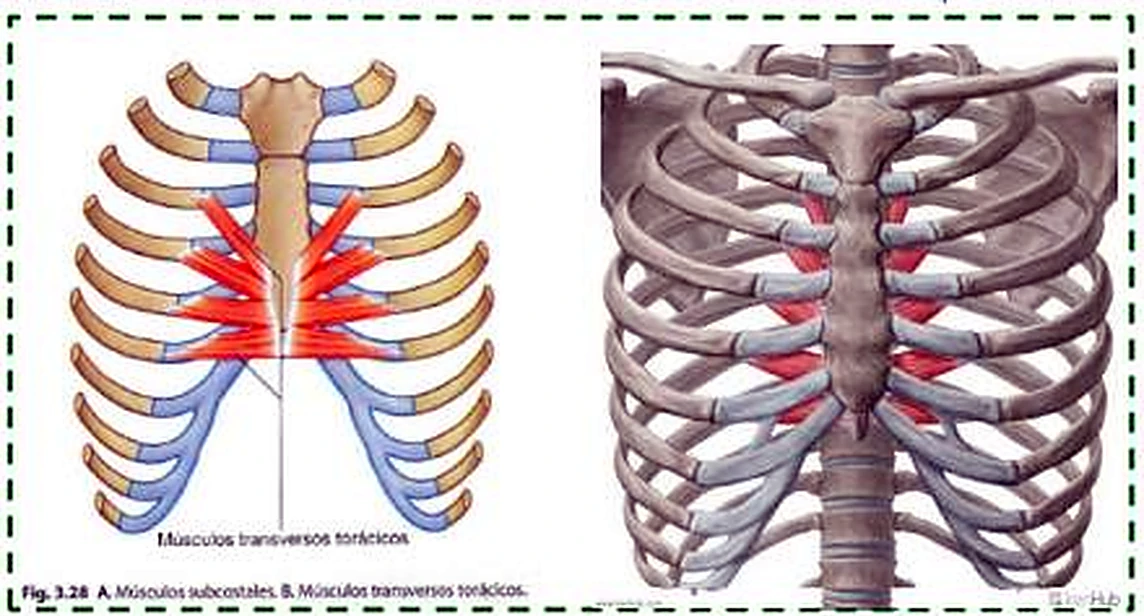La pared torácica anterior por dentro, con músculos rojos que van del esternón a los cartílagos costales.