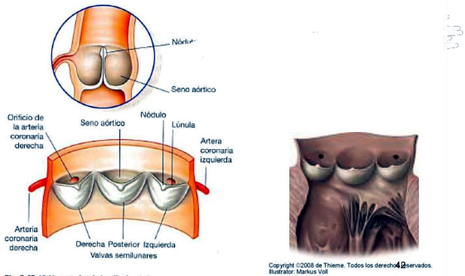 La aorta abierta, con tres valvas y las dos arterias coronarias en rojo.