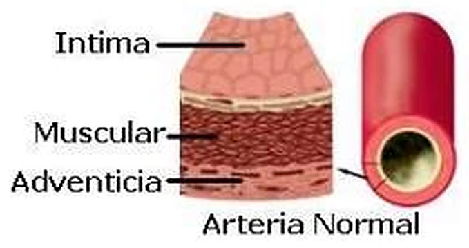 Un fragmento de pared arterial y un vaso arterial seccionado.